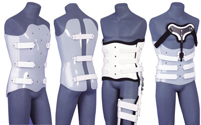 Molded Jackets: A Type of Spinal Brace