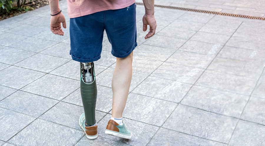 Learn How to Walk with a Prosthetic Limb